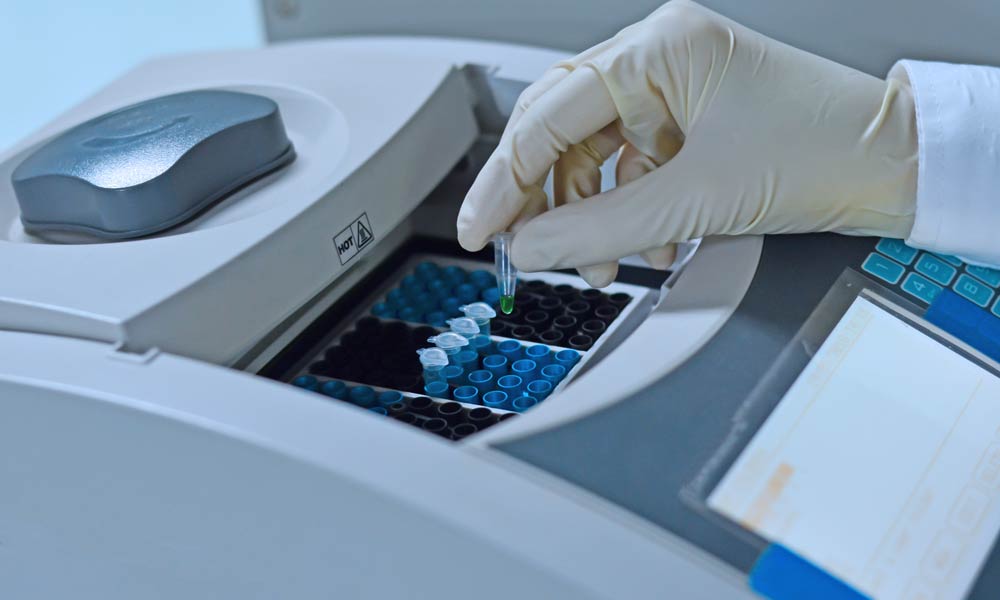 pcr-coronavirus-zaragoza
