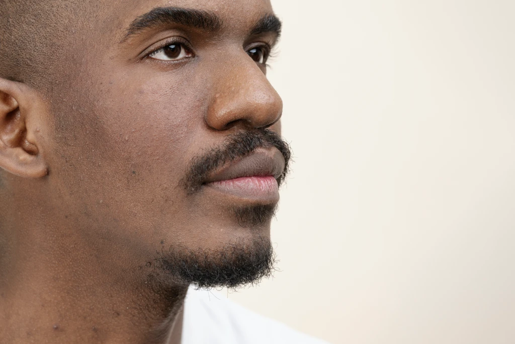 Primer plano de la cara de un hombre con la nariz ancha