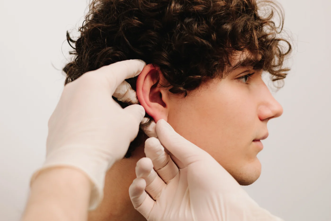 otoplastia persona joven